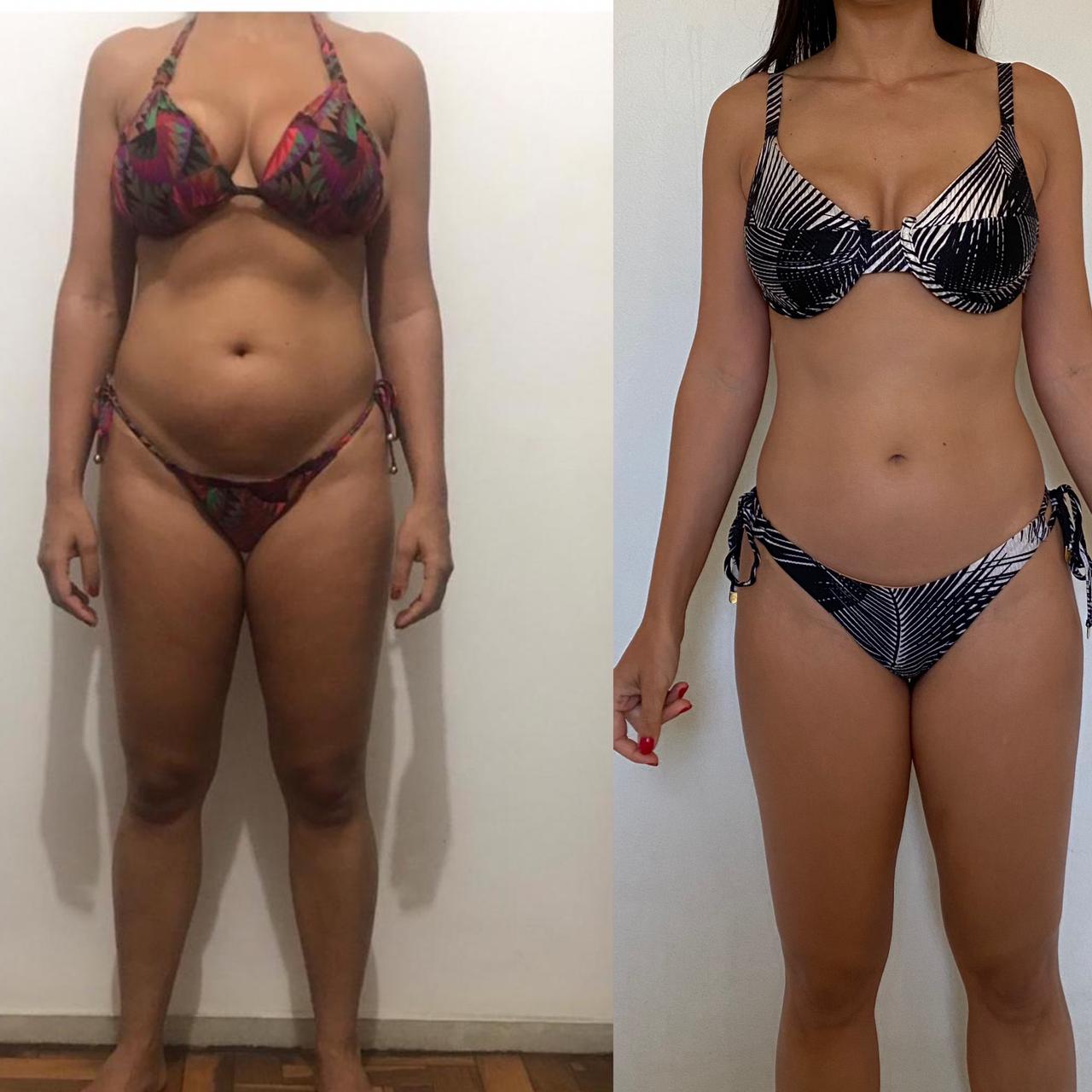 Antes e depois - Prova 2